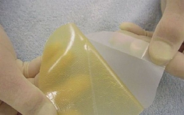 پژوهشگران دانشگاه صنعتی امیرکبیر موفق به تولید پانسمان‌های پلیمری شدند